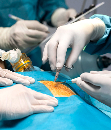 Laparoscopic Surgery