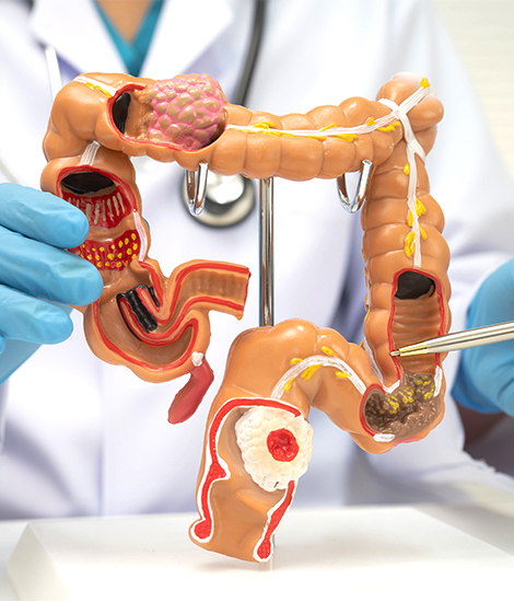 Colorectal Surgery